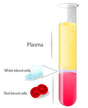 PRP Therapy Dubai